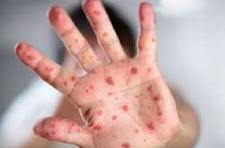 Кір знову набирає обертів в Україні