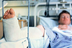 Найчастіше під час падіння через ожеледицю травмуються ноги