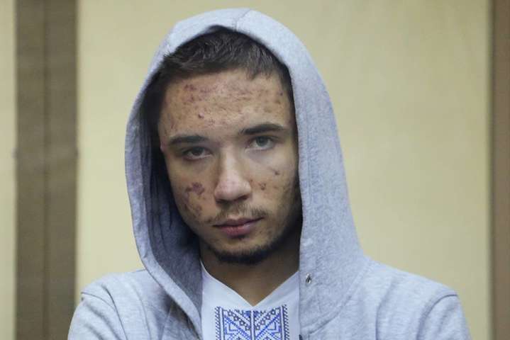 Павло Гриб з дитинства має інвалідність - має синдром портальної гіпертензії, тому потребує постійного медичного догляду - Адвокат Марина Дубровіна: Павло Гриб практично осліп