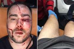 У Запоріжжі побили лідера організації «Авто Євро Сила» Влада Погорєлова