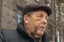 81-річний  Віктор Ковальський отримав струс мозку, пошкодження зуба і спини 