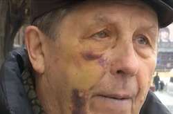  Авіаконструктор Віктор Ковальський внаслідок нападу отримав струс мозку 