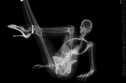 Игривые скелетики: креативные рентгеновские снимки из медицинского календаря взбудоражили сеть