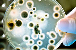 У Львові чоловік помер від лептоспірозу 