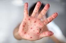 У школах та садочку села Шевченкове оголосили карантин