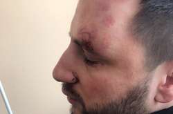 У Борисполі двоє чоловіків побили директора Ольги Цибульської