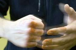 На Львівщині голові райсуду зламали ногу 