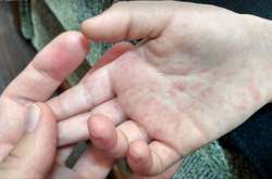 У МОЗі закликають батьків щеплюватися і щеплювати дітей