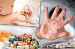 З 2017 року від ускладнень через кір померло 27 українців