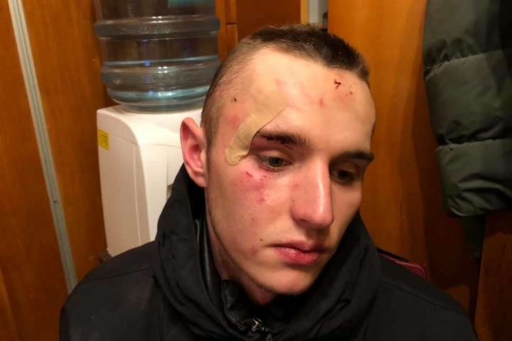 З’явилася фотографія одного з побитих поліцією у Києві