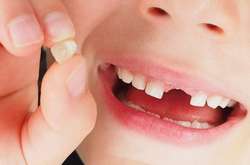 Молочные зубы могут помочь определить риски развития шизофрении и депрессии