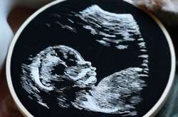 Художница вышивает снимки УЗИ беременных женщин: необычные фото