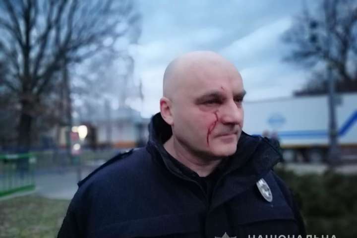 Внаслідок сутичок у Черкасах постраждало 15 поліцейських