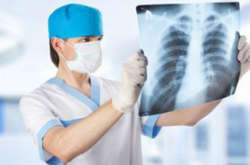 В Україні щодня помирають 10 хворих на туберкульоз