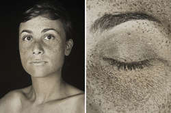 УФ-портреты показали, как солнечный свет повреждает кожу