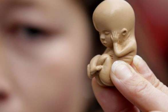 387 неповнолітніх українок протягом року зробили аборти