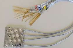 Вчені створили імплант, який може «читати думки»