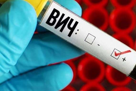 Одеські медики за кожного виявленого ВІЛ-інфікованого отримуватимуть 500 грн