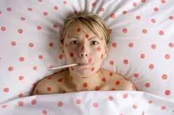 На кір з початку року захворіли майже 50 тисяч українців