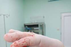 Протести в Грузії: кілька сотень людей поранені 