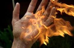 Житель Запорожья из-за ревности облил свою девушку зажигательной смесью и поджог