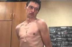 Чоловік вибіг оголеним із під’їзду і почав неадекватно себе поводити