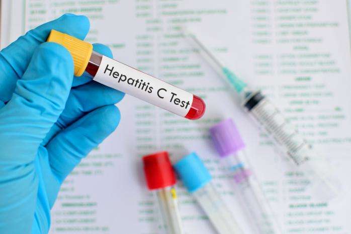 Лікарні у регіонах отримають безоплатні ліки для пацієнтів із вірусним гепатитом С