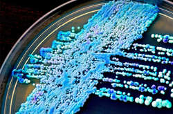 Дріжджові гриби виду Candida: багато видів цих грибів нешкідливі, проте деякі стають збудниками небезпечних недуг