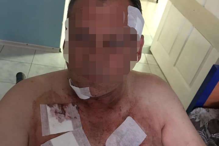 Під Києвом 18-річний хлопець з ножем напав на таксиста (фото, відео)