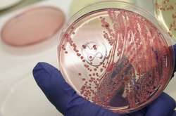 У Білорусі виявили сибірську виразку