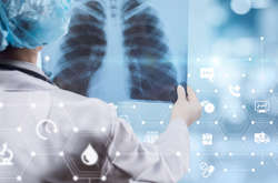 Минздрав создал онлайн-тест для проверки на туберкулез