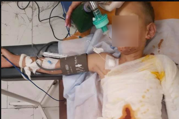 У Дніпрі діти підпалили 8-річного хлопчика, він у реанімації