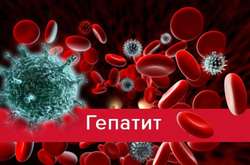 Львівські студенти, які були на практиці в Одесі, захворіли на гепатит «А»