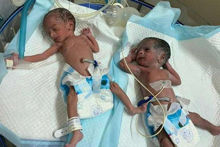 73-летняя индианка родила близняшек