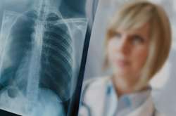 Рада планує врегулювати радіаційний захист при медичному опроміненні