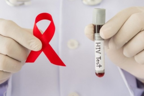 В Одесі реалізовано пілотний проєкт щодо максимального охоплення тестуванням на ВІЛ