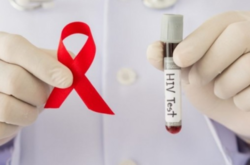 В Одесі реалізовано пілотний проєкт щодо максимального охоплення тестуванням на ВІЛ