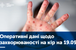 Втричі зросла кількість хворих на кір у Вінницькій області