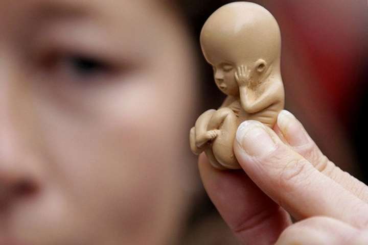 Австралия легализовала аборты
