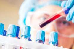 Гемоглобін – білок крові, він містить залізо та транспортує кисень до тканин усіх органів. Якщо гемоглобін нижчий за 120 – це заниження від норми і називається анемією