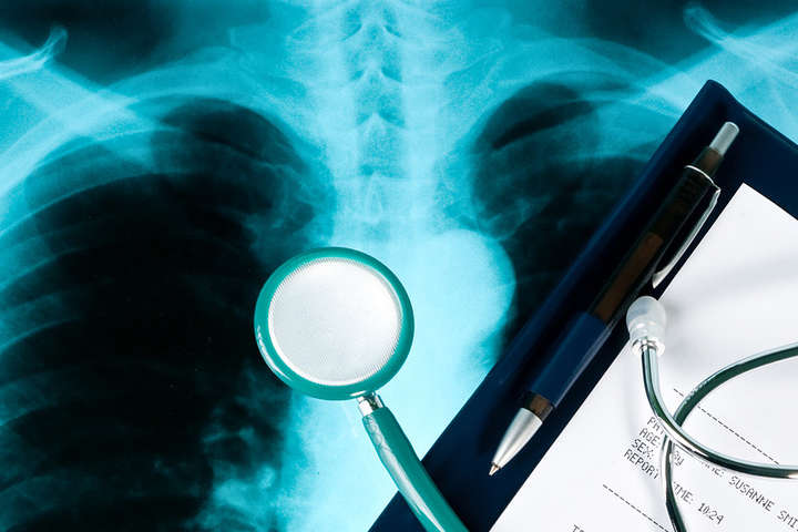 Багато людей не знають, що мають смертельно небезпечну хворобу легенів ХОЗЛ