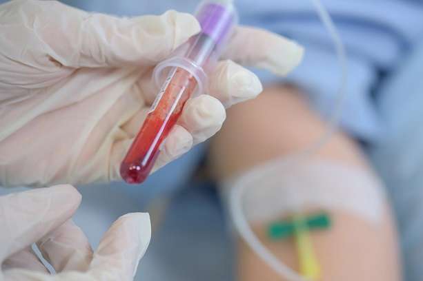 Дев'ятеро людей у Харківській області захворіли на гепатит 