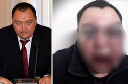 У Росії побили металевою трубою депутата, який критикував владу