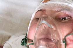 Активистка Екатерина Гандзюк умерла 4 ноября 2018 года