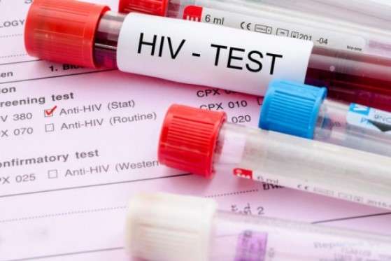 В Одесі покращилися показники діагностики та лікування ВІЛ-інфекції