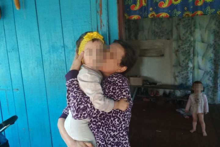 Справжній трилер на Житомирщині: батьки спалили дочку і отримали грошову допомогу