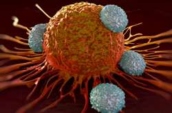 Знайдено спосіб запобігти смертельній стадії раку