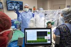 Лікарі вставили у мозок людини імпланти, щоб допомогти боротися з наркотичною залежністю