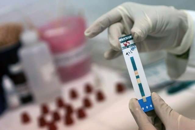 Експериментальна вакцина проти ВІЛ показала високу ефективність на тестуванні