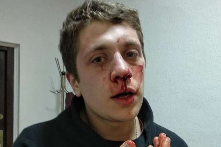 Активісти з Дніпра, на яких скоїли напад, розповіли, з чим пов’язують інцидент